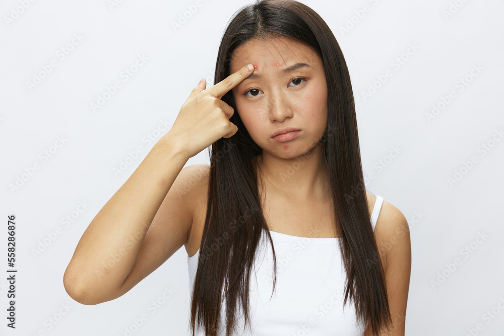 Asian woman facial skin problems, acne and inflammation, red rashes and allergies, chicken pox, sadness from rashes. Facial skin care concept for diseases and nerves Asian woman facial skin problems, acne and inflammation, red rashes and allergies, chicken pox, sadness from rashes. Facial skin care concept for diseases and nerves