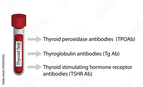 Thyroid test,Thyroid gland.  Thyroglobulin, Thyroid peroxidase and Thyroid stimulating hormone receptor antibodies. Hypothyroidism and hyperthyroidism. Endocrinology,  Autoimmune. Vector illustration.