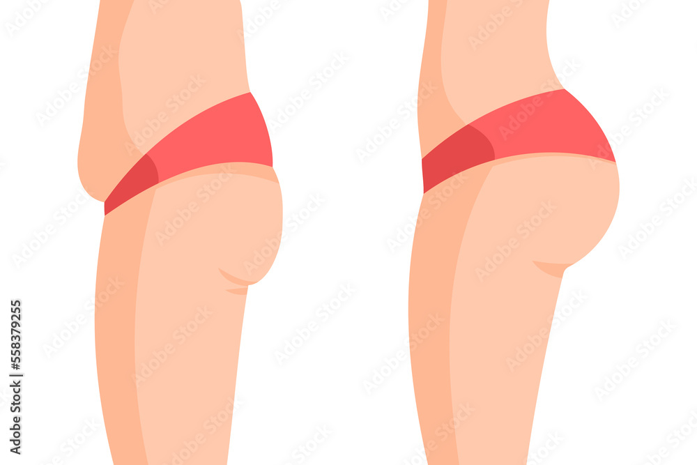 Vector image of a fat and a fit butts and bellys side view. Concept of before losing weight and after doing sports Vector image of a fat and a fit butts and bellys side view. Concept of before losing weight and after doing sports