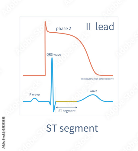 Fotografie The ST segment of the ECG is equivalent to the second phase of the ventricular muscle action potential curve, usually located on the isoelectric line