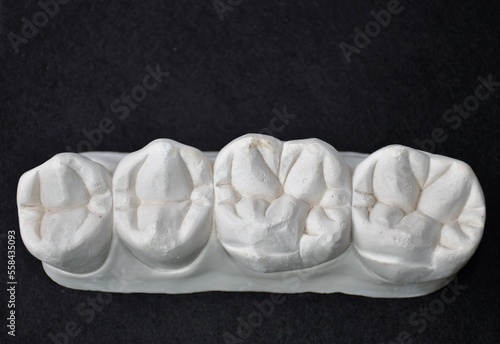 Fotografie Maxillary premolars and molars in white plaster on a dark background