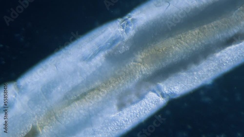 Ceratopogonidae biting midge larva stage in water under microscope photo