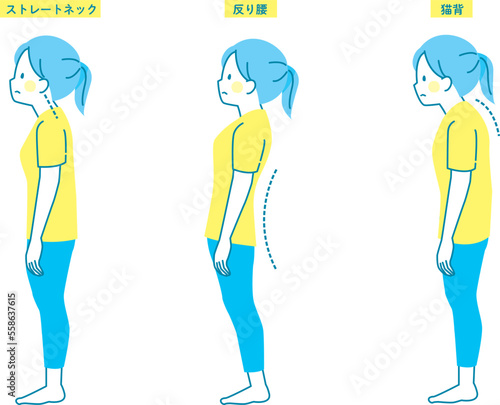 女性の良い姿勢と悪い姿勢の見本