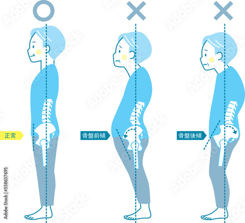 シニア男性の良い姿勢と悪い姿勢の見本_骨盤