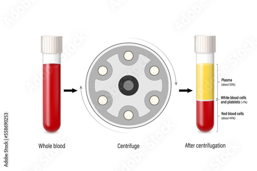 Diagram showing blood put into the centrifuge and blood divided into 3 layers. Plasma, white blood cells, platelets and red blood cells.