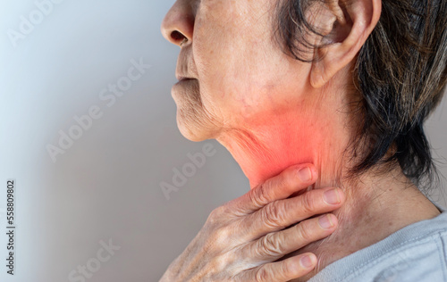 Wallpaper Mural Redness at the neck of Asian, Myanmar woman. Concept of sore throat, pharyngitis, laryngitis, esophagitis, thyroiditis, or dysphagia. Torontodigital.ca