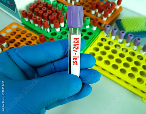 Blood sample for Influenza A H3N2 variant viruses (also known as “H3N2v” viruses) test photo