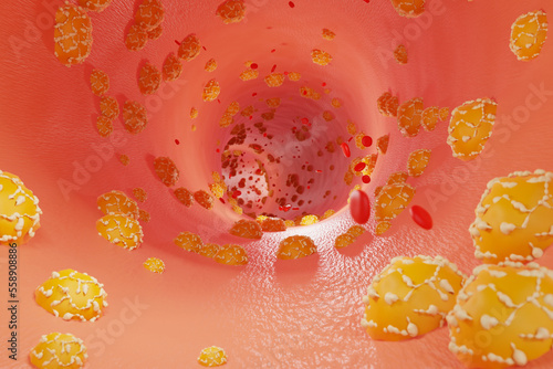 Hyperlipidemia concept. Fat deposits in blood vessels and red blood cell flow. Health care and medical. 3d render. photo