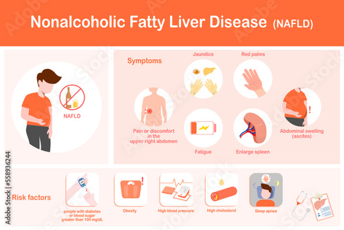 Vector illustration of non-alcoholic fatty liver disease (NAFLD), symptoms and risk factors in flat style.