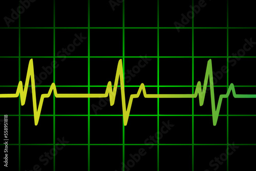 Vector illustration of heart rate and pulse graph