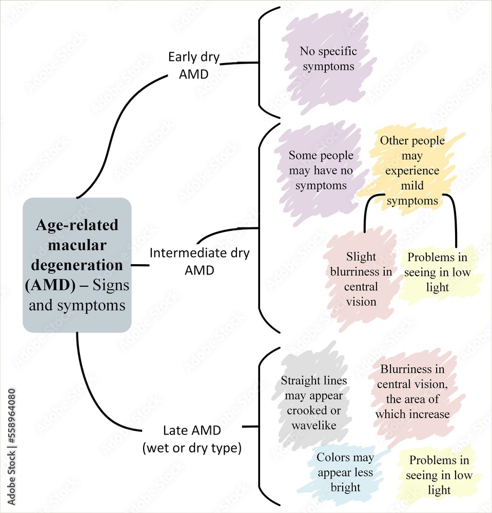 Signs and symptoms of Age-related macular degeneration (AMD) Stock ...