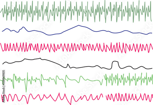 Ekg heart rate monitor. Healthcare concept using technology.