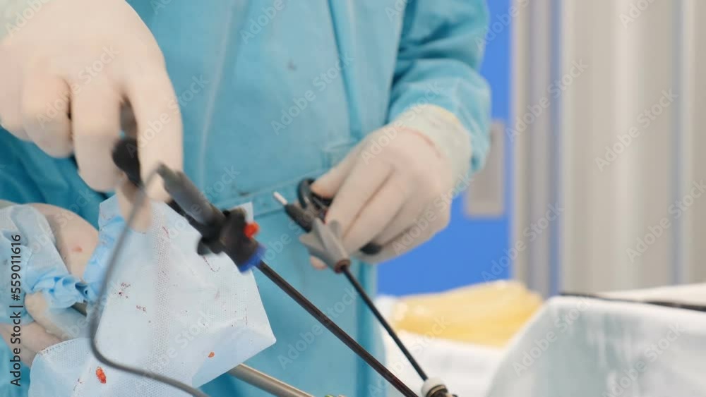 Laparoscopic cholecystectomy instrument. Real Surgery, abdominal incision, working with surgical