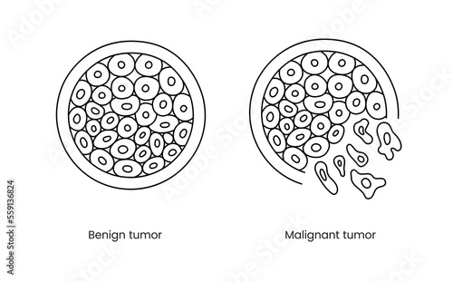 Benign and malignant tumor line icon in vector, illustration of oncology.