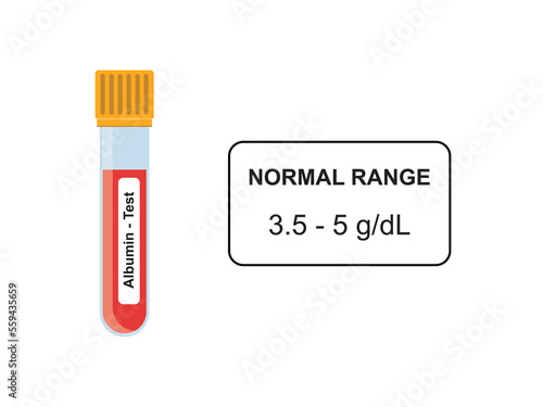 Albumin Blood Test Concept Design. Vector Illustration.