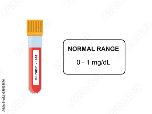 Bilirubin Blood Test Concept Design. Vector Illustration.