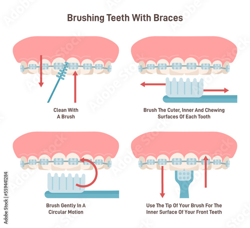 Brushing teeth with braces system. Oral care with special brush.