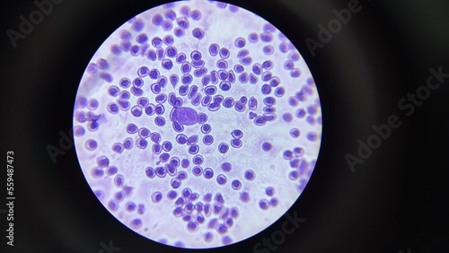 blood smear thick drop