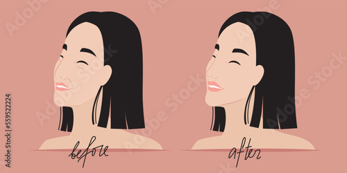 Female face before and after plastic surgery, receiving hardware cosmetology procedure. Beautiful smiling Asian woman with bob haircut. Flabby chin, wrinkles. Anti-aging procedures. Vector