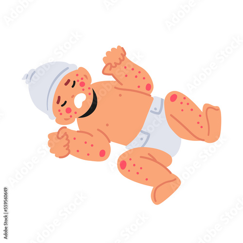 Newborn Child with Food Allergy Symptoms Red Itchy Spots on Body and Face. Little Baby Character Crying of Pain