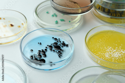 Petri dishes with different bacteria colonies on white background  closeup