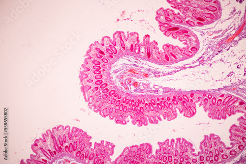 Tissue of Small intestine (Duodenum), Large intestine Human and Stomach Human under the microscope in Lab.