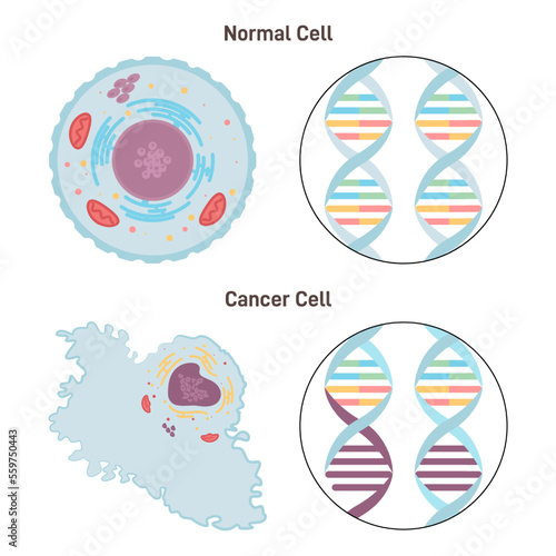Normal and cancer cells. Difference between healthy tissue and tumor