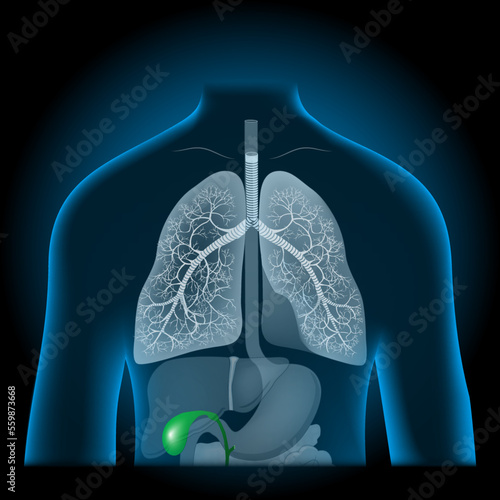 Green gallbladder into x-ray blue realistic torso.