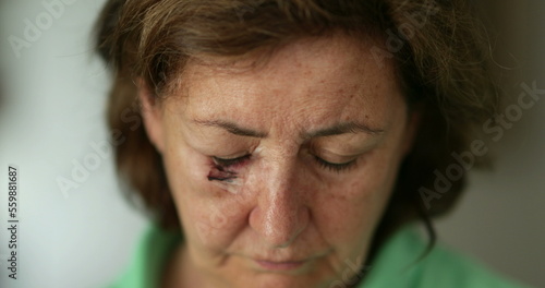 Tableau sur toile Older woman with bruise scar face opening eyes looking to camera