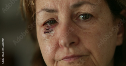 Close-up of older woman bruised, scarred face looking to camera