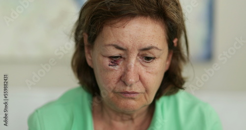 Bruised older woman with scar looking to camera with sad emotion photo