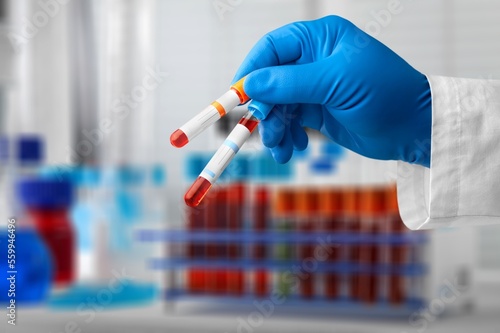 Medical hand blood or medical test tubes in hospital photo