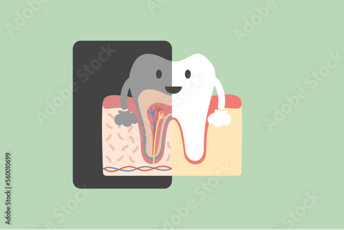 Dental x-ray, tooth holding x-ray film that showing the internal structure of the teeth - dental cartoon vector flat style