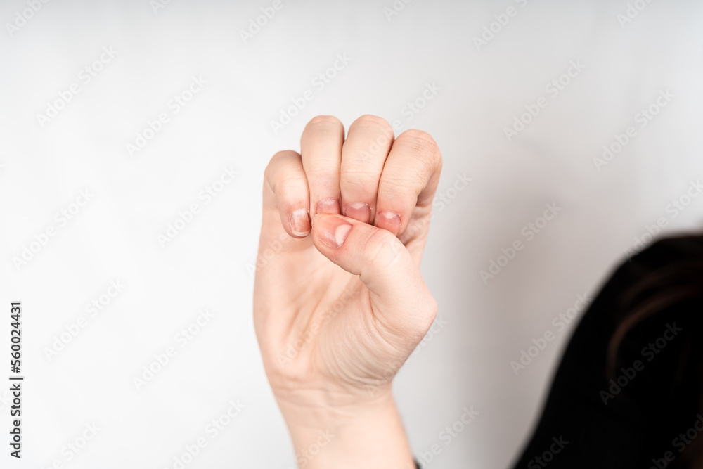 E letter , Static Hand Gestures for American Sign Language Letters,The 26 hand signs of the ASL Language., sign language of people with hearing loss communitie E letter , Static Hand Gestures for American Sign Language Letters,The 26 hand signs of the ASL Language., sign language of people with hearing loss communitie