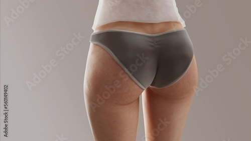 The process of losing weight.Close-up of the female buttocks and thighs (ID: 560149402)