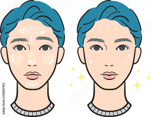 脂性肌の若い男性のビフォーアフター