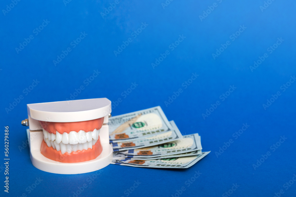Closeup model of a human jaw with white teeth and dollar bill ...