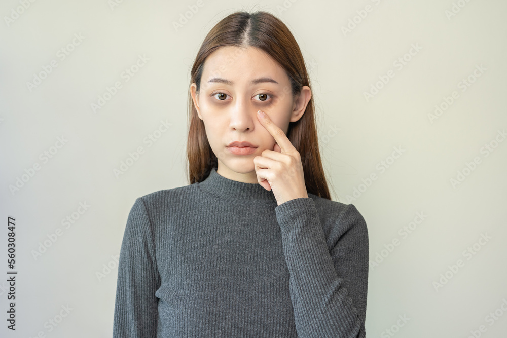 Bored, insomnia asian young woman, girl looking at camera, hand touching under eyes with problem of black circles or panda puffy, swollen and wrinkle on face. Sleepless, sleepy healthcare person. Bored, insomnia asian young woman, girl looking at camera, hand touching under eyes with problem of black circles or panda puffy, swollen and wrinkle on face. Sleepless, sleepy healthcare person.