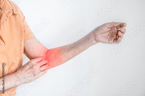 Asian woman scratching her arm. Concept of itchy skin diseases such as scabies, fungal infection, eczema, psoriasis, rash, allergy, etc.