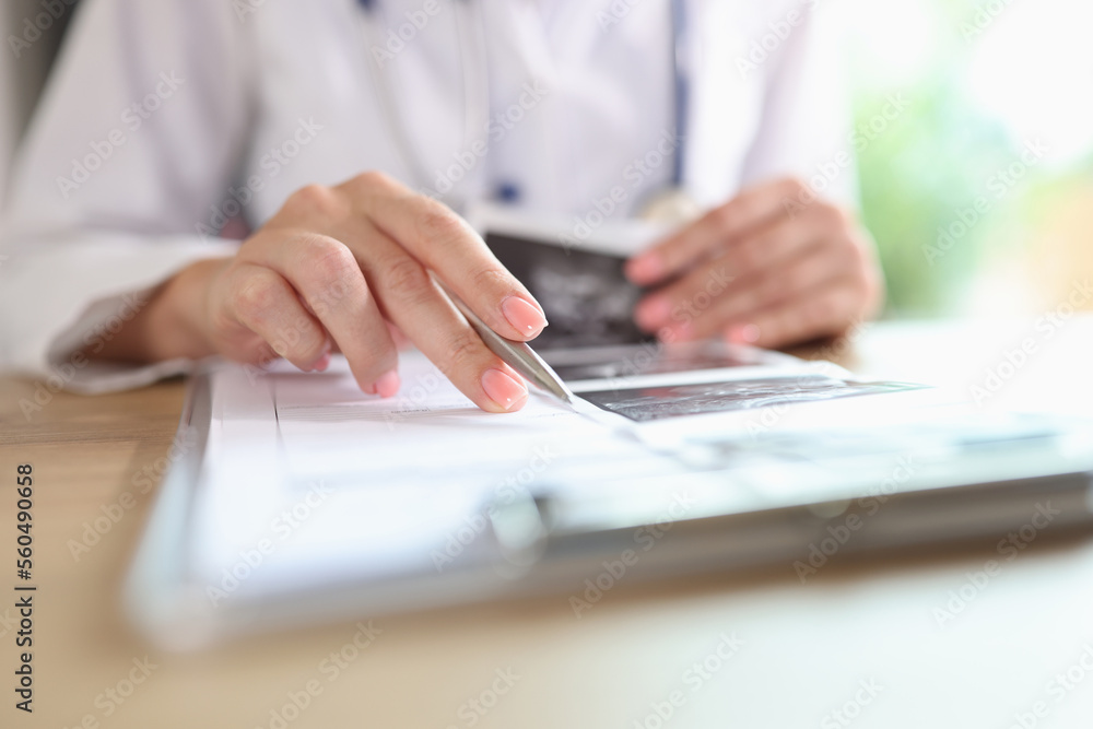 Close up of doctor is engaged in paper work, fills in medical records of patients. Close up of doctor is engaged in paper work, fills in medical records of patients.