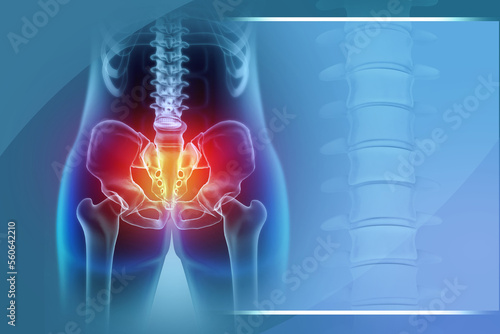 Obraz na płótnie Hip painful skeleton x-ray. Medical concept. 3d illustration