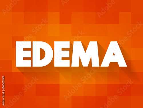 Edema is swelling caused by excess fluid trapped in your body's tissues, text concept for presentations and reports