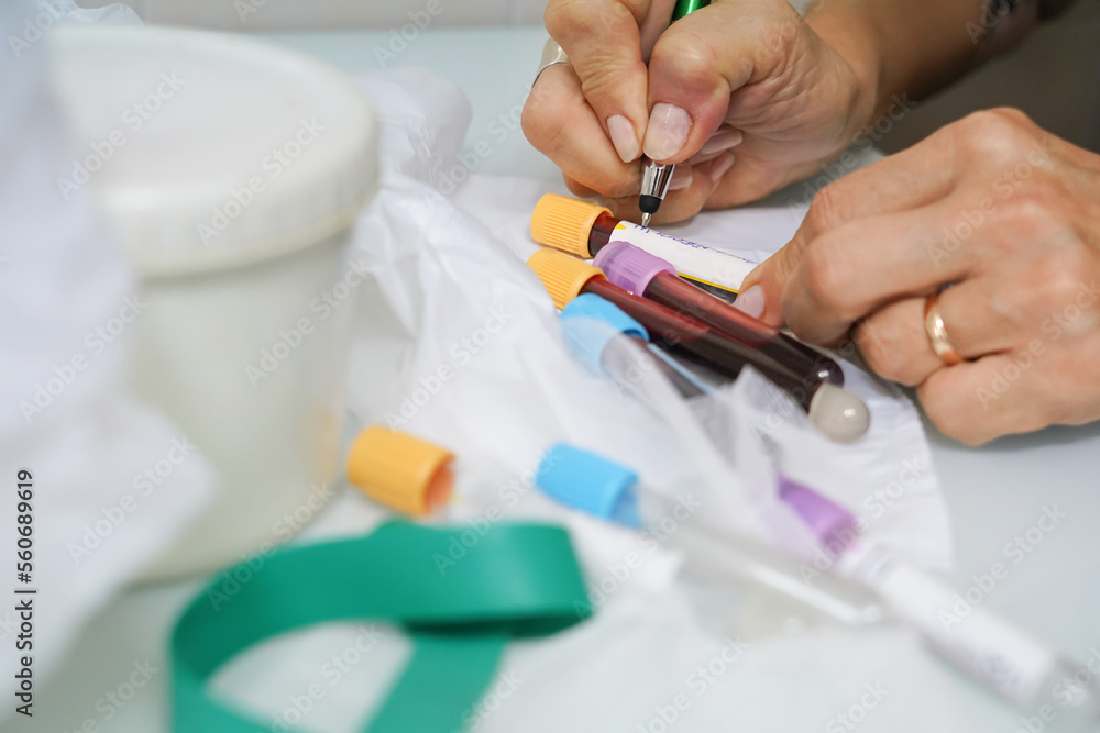 unrecognizable nurse writes on some blood tubes. draw blood at home unrecognizable nurse writes on some blood tubes. draw blood at home