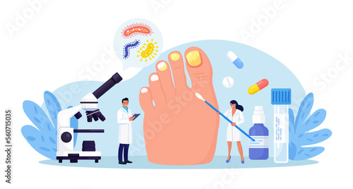 Onychomycosis. Feet with nail disease. Fungal nails infection. Doctors exam, treat nails psoriasis. Doctor dermatologist analyzes psoriatic toenails. Inflammation of toenail skin. Medical treatment photo