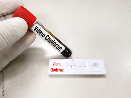 Blood sample and rapid test device or cassette for Vibrio cholerae test, show positive result photo