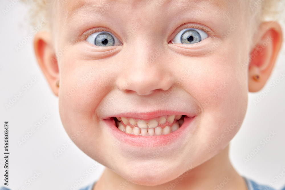 Happy caucasian kid girl has broad smile, shows perfect teeth over white studio background. White curly hair and blue eyes. cheerful excited child look at camera, surprised. human emotions concept Happy caucasian kid girl has broad smile, shows perfect teeth over white studio background. White curly hair and blue eyes. cheerful excited child look at camera, surprised. human emotions concept