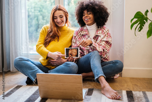 Lgtbi couple showing the ultrasound of their future child to their family online - motherhood and technology concept