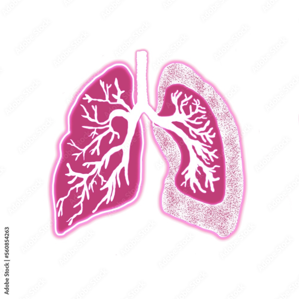 pneumothorax findings, bronchus, free air, trachea pneumothorax findings, bronchus, free air, trachea