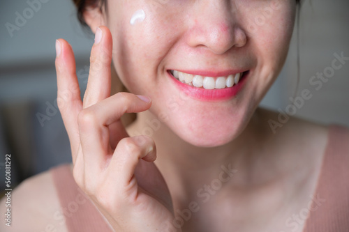 Cropped shot of Asian woman applying cream on her face for treating redness skin.
