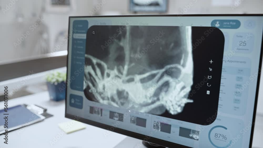 Close Up of a Computer Screen with Veterinary Clinic Online Medical Database Software with a Pet Tortoise X-Ray Scans. Two Veterinarians Discussing Work, Pointing at the Display and Gesturing Close Up of a Computer Screen with Veterinary Clinic Online Medical Database Software with a Pet Tortoise X-Ray Scans. Two Veterinarians Discussing Work, Pointing at the Display and Gesturing